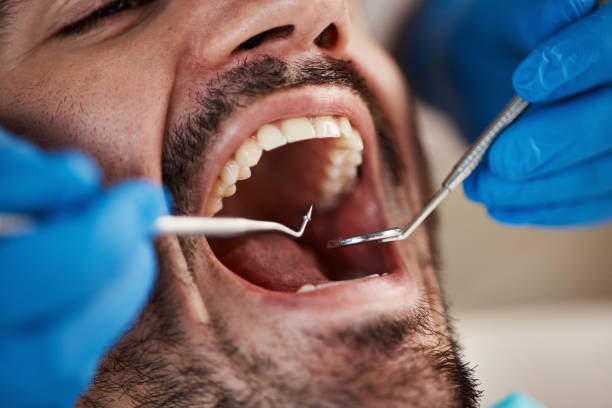 Best Emergency Tooth Extraction in King, NC